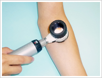 ダーモスコピー